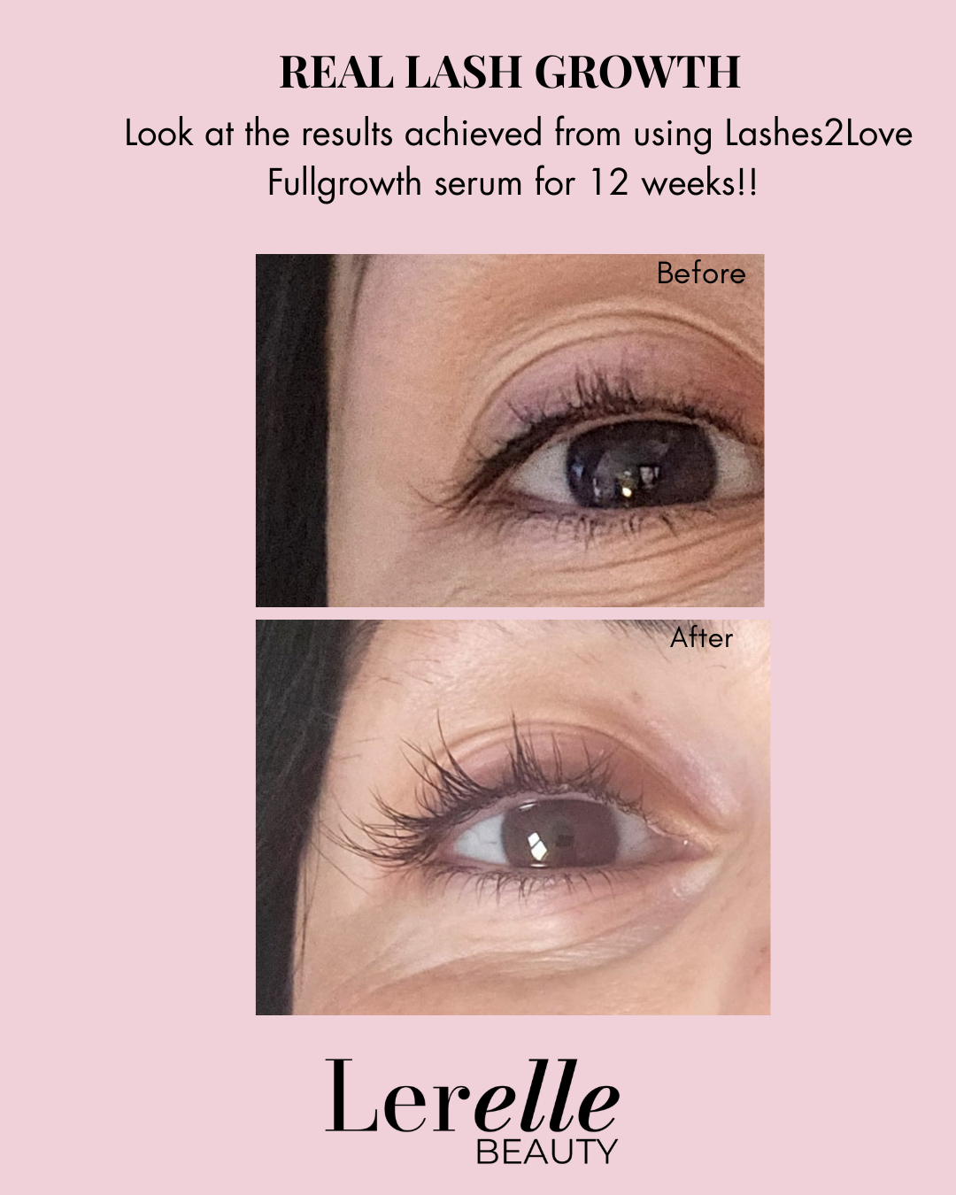 before and after results 
