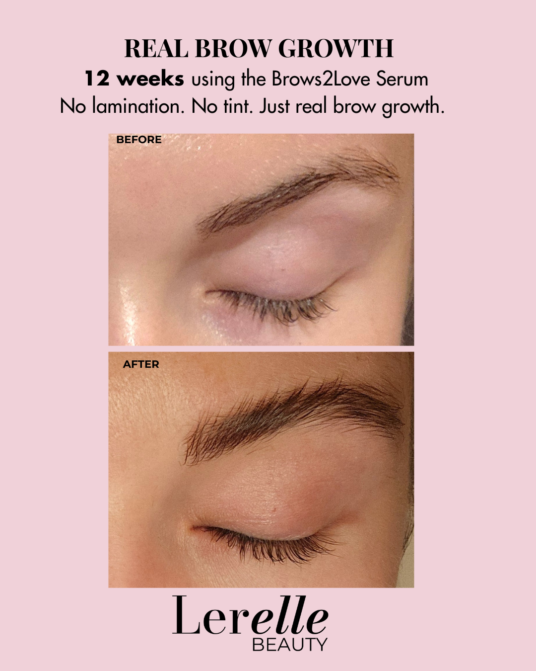 before and after results 
